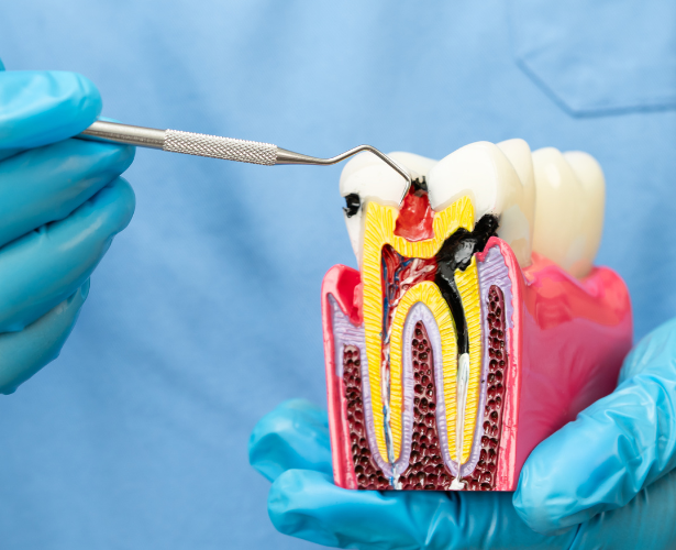Dentist presenting digital tooth anatomy during root canal consultation